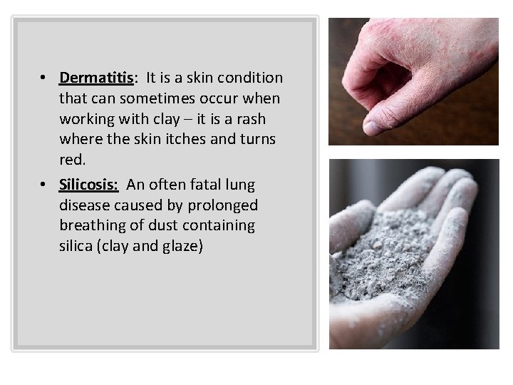  • Dermatitis: It is a skin condition that can sometimes occur when working