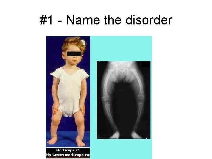 #1 - Name the disorder 