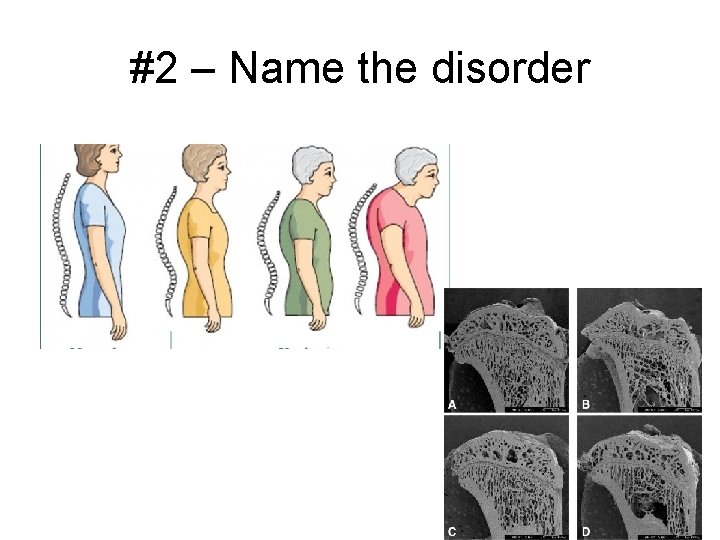 #2 – Name the disorder 