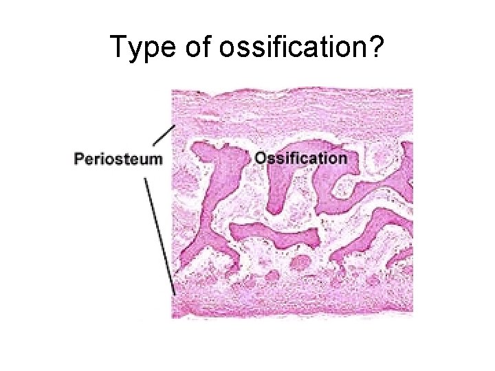 Type of ossification? 