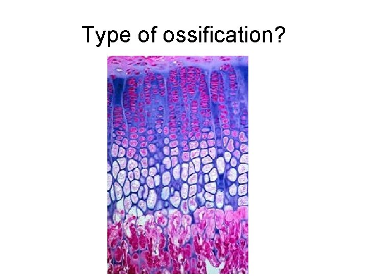 Type of ossification? 
