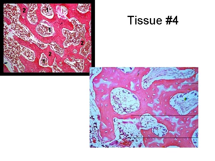 Tissue #4 