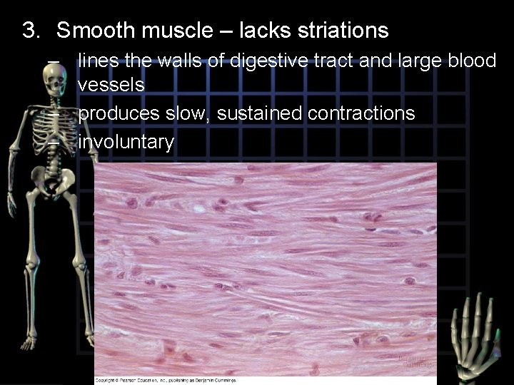 3. Smooth muscle – lacks striations – lines the walls of digestive tract and