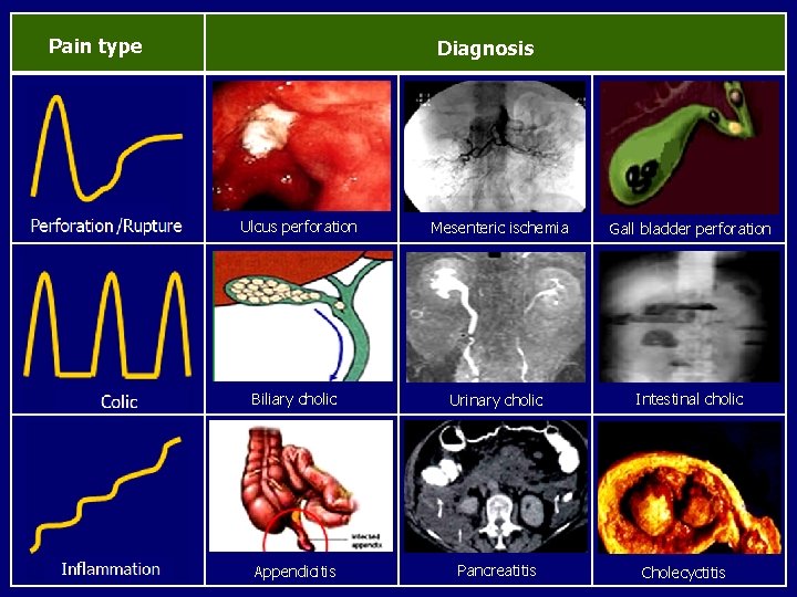 Pain type Diagnosis Ulcus perforation Mesenteric ischemia Gall bladder perforation Biliary cholic Urinary cholic