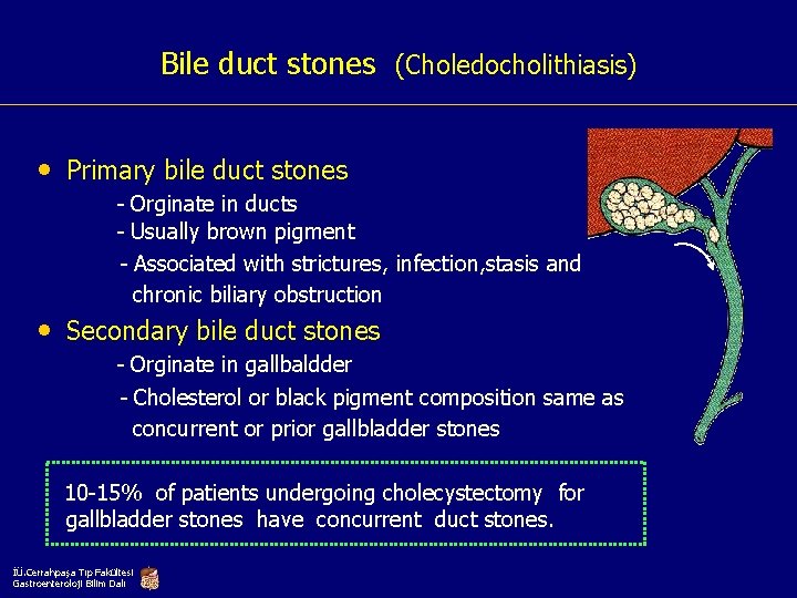 Bile duct stones (Choledocholithiasis) • Primary bile duct stones - Orginate in ducts -