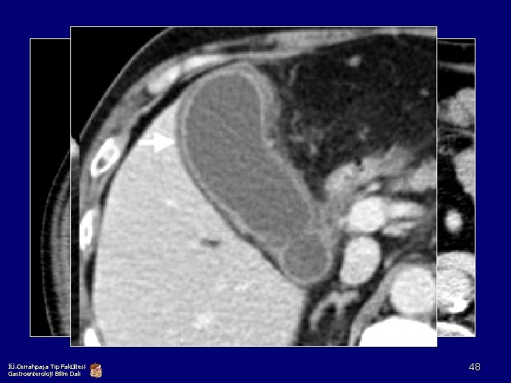 İÜ. Cerrahpaşa Tıp Fakültesi Gastroenteroloji Bilim Dalı 48 