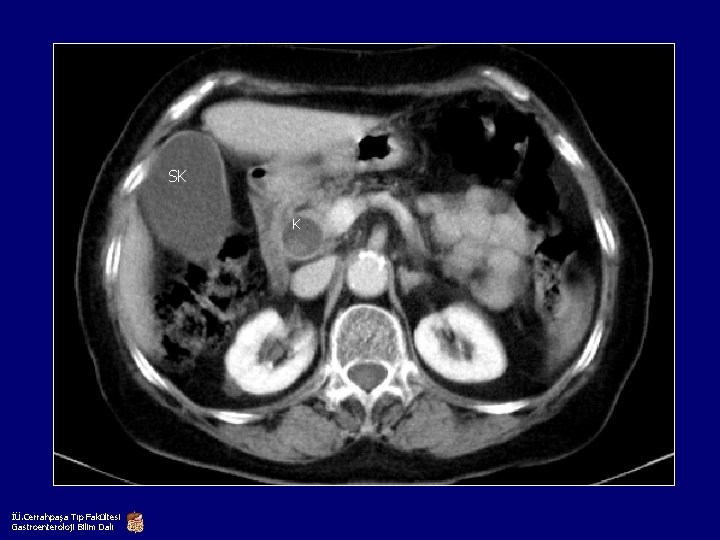 SK K İÜ. Cerrahpaşa Tıp Fakültesi Gastroenteroloji Bilim Dalı 
