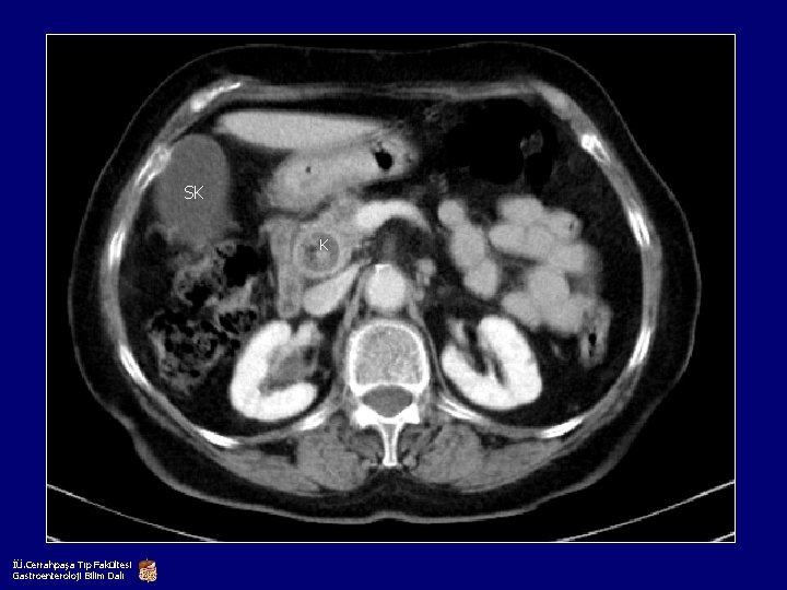 SK K İÜ. Cerrahpaşa Tıp Fakültesi Gastroenteroloji Bilim Dalı 