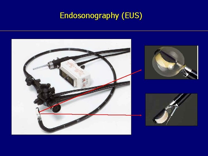 Endosonography (EUS) 