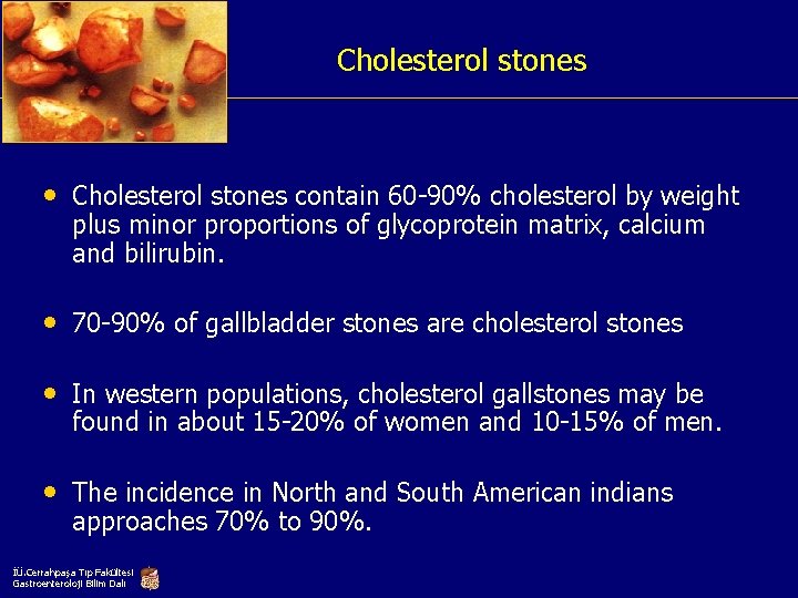 Cholesterol stones • Cholesterol stones contain 60 -90% cholesterol by weight plus minor proportions