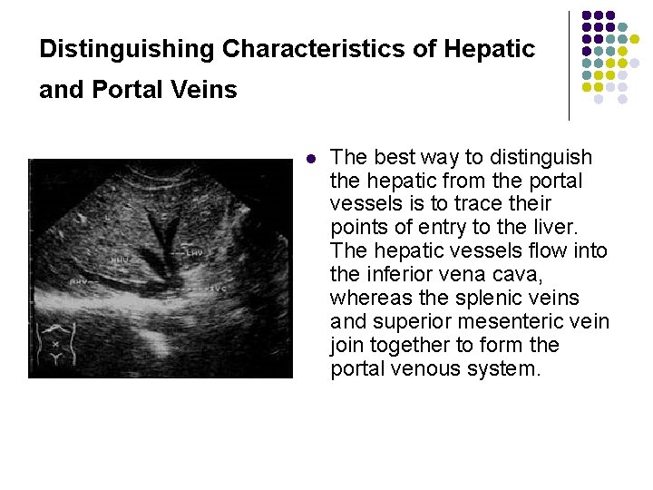 Distinguishing Characteristics of Hepatic and Portal Veins l The best way to distinguish the