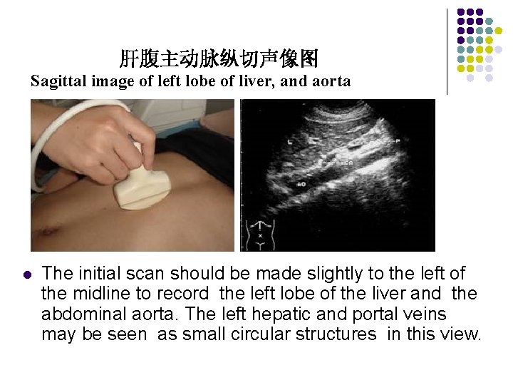 肝腹主动脉纵切声像图 Sagittal image of left lobe of liver, and aorta l The initial scan