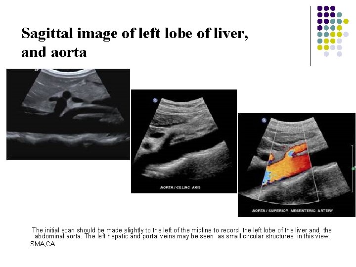 Sagittal image of left lobe of liver, and aorta The initial scan should be