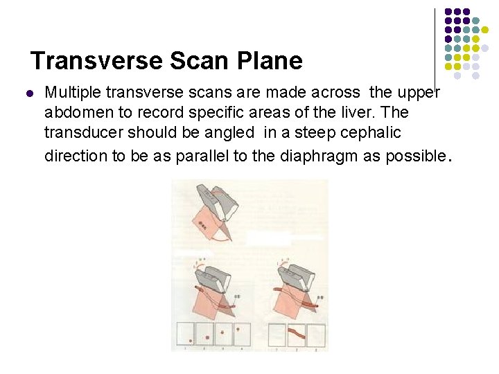 Transverse Scan Plane l Multiple transverse scans are made across the upper abdomen to