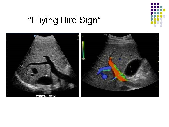 “Fliying Bird Sign” 