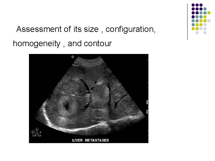 Assessment of its size , configuration, homogeneity , and contour 