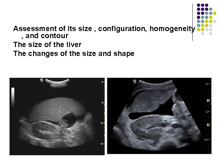 Assessment of its size , configuration, homogeneity , and contour The size of the