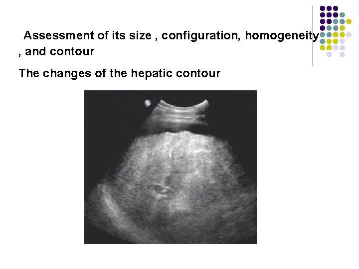 Assessment of its size , configuration, homogeneity , and contour The changes of the