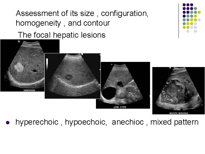 Assessment of its size , configuration, homogeneity , and contour The focal hepatic lesions