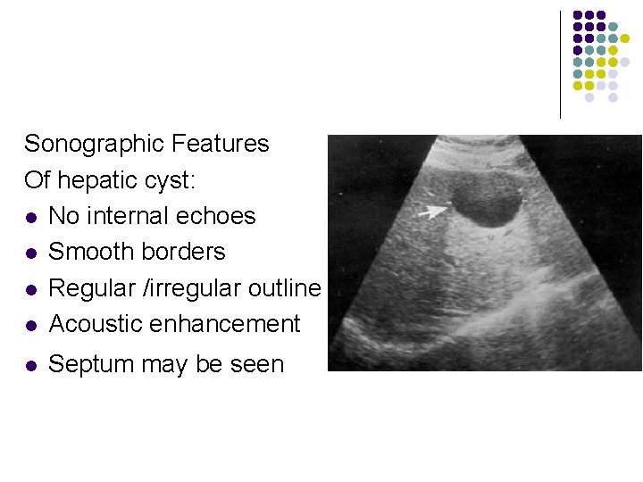 Sonographic Features Of hepatic cyst: l No internal echoes l Smooth borders l Regular