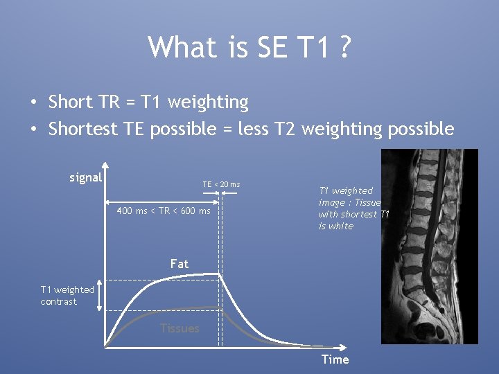 What is SE T 1 ? • Short TR = T 1 weighting •