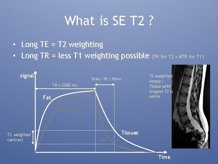What is SE T 2 ? • Long TE = T 2 weighting •