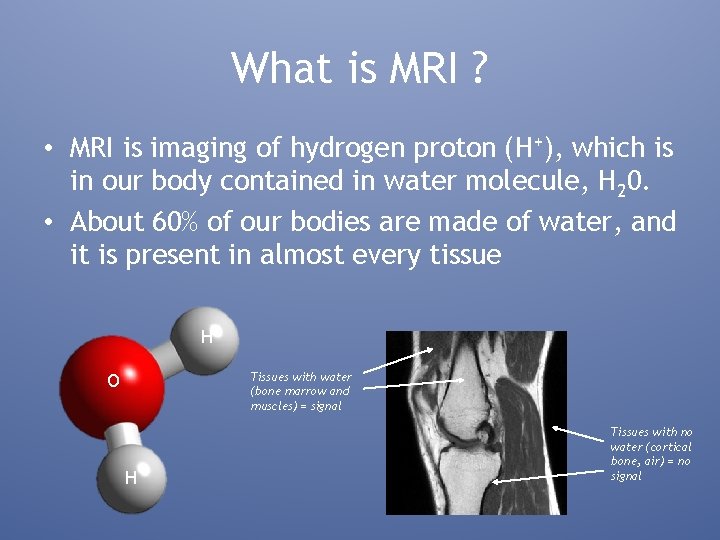 What is MRI ? • MRI is imaging of hydrogen proton (H+), which is