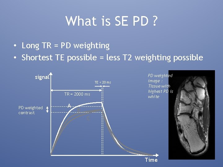 What is SE PD ? • Long TR = PD weighting • Shortest TE