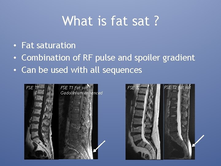 What is fat sat ? • Fat saturation • Combination of RF pulse and