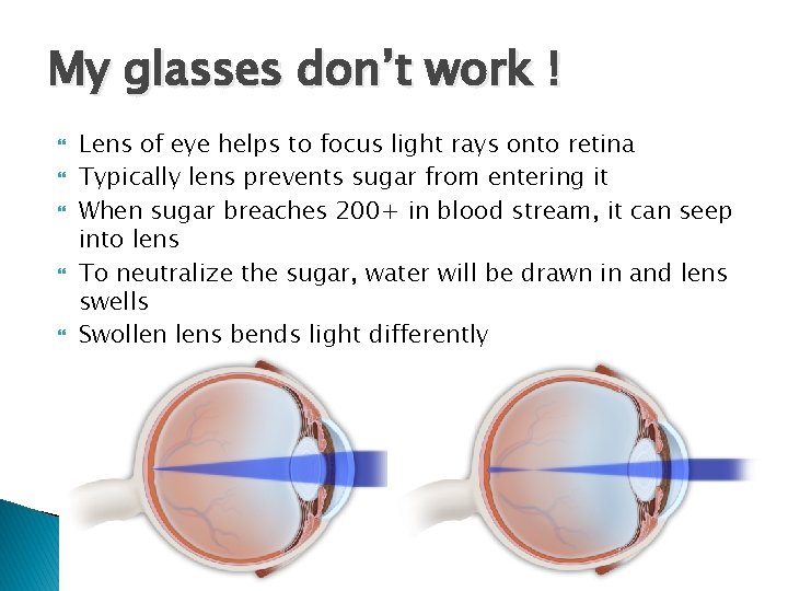 My glasses don’t work ! Lens of eye helps to focus light rays onto