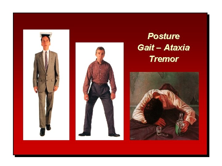 Posture Gait – Ataxia Tremor 