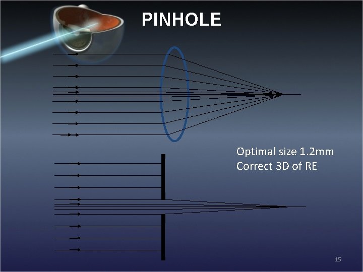 PINHOLE Optimal size 1. 2 mm Correct 3 D of RE 15 