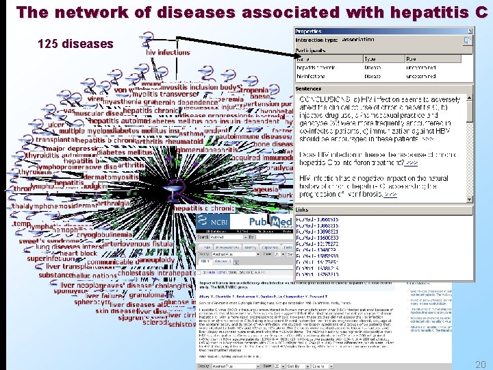 The network of diseases associated with hepatitis C 125 diseases 20 