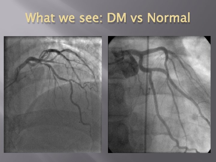 What we see: DM vs Normal 