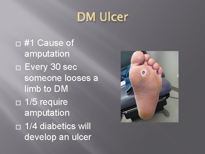 DM Ulcer � � #1 Cause of amputation Every 30 sec someone looses a