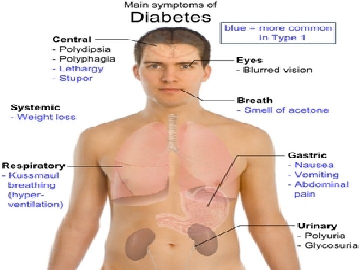 Diabetes symptoms 