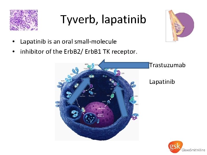 Tyverb, lapatinib • Lapatinib is an oral small-molecule • inhibitor of the Erb. B