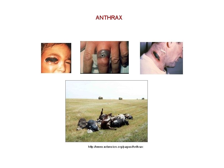 ANTHRAX http: //www. extension. org/pages/Anthrax 