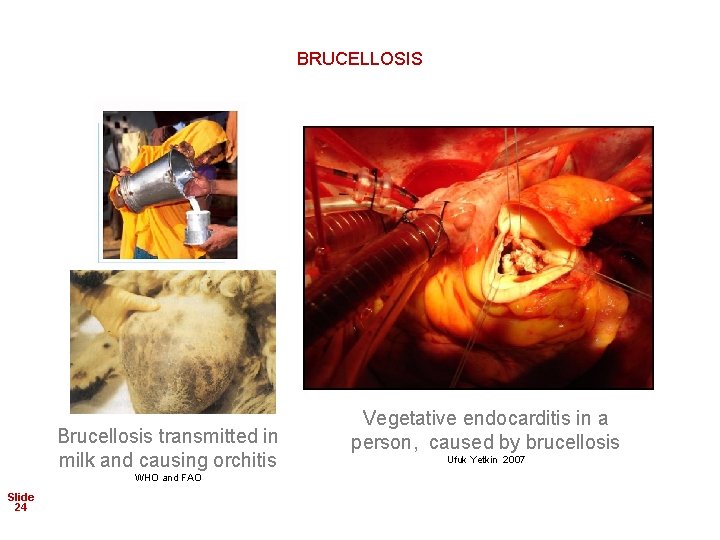 BRUCELLOSIS Brucellosis transmitted in milk and causing orchitis WHO and FAO Slide 24 Vegetative
