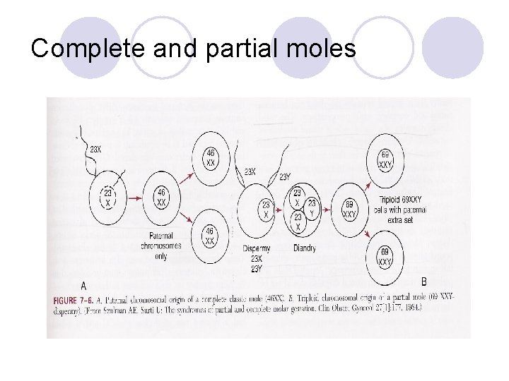 Complete and partial moles 