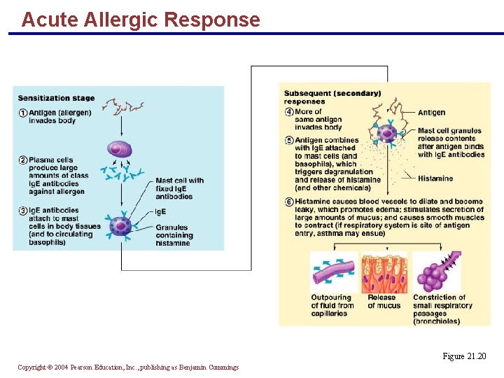 Acute Allergic Response Figure 21. 20 Copyright © 2004 Pearson Education, Inc. , publishing