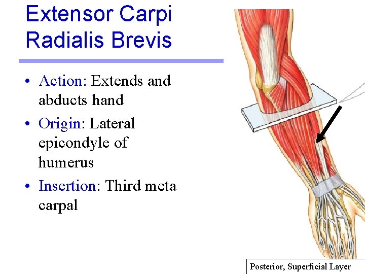 Extensor Carpi Radialis Brevis • Action: Extends and abducts hand • Origin: Lateral epicondyle