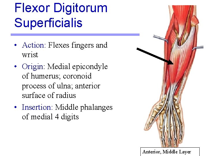 Flexor Digitorum Superficialis • Action: Flexes fingers and wrist • Origin: Medial epicondyle of