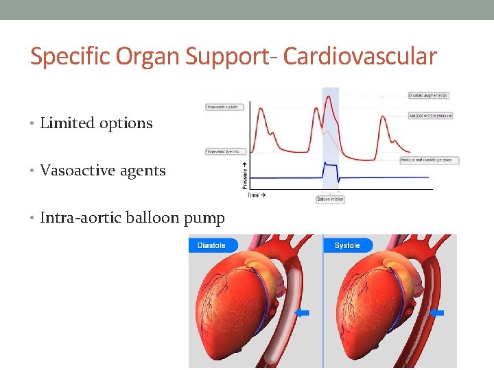 Specific Organ Support- Cardiovascular • Limited options • Vasoactive agents • Intra-aortic balloon pump