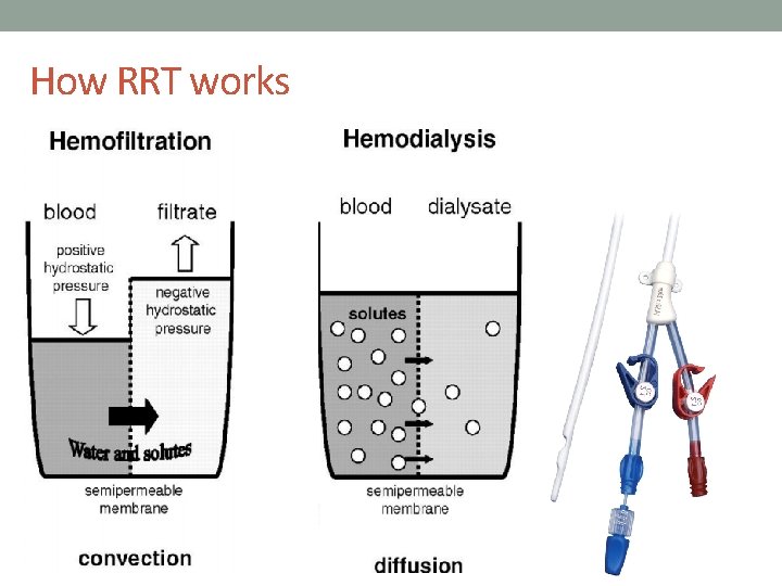 How RRT works 