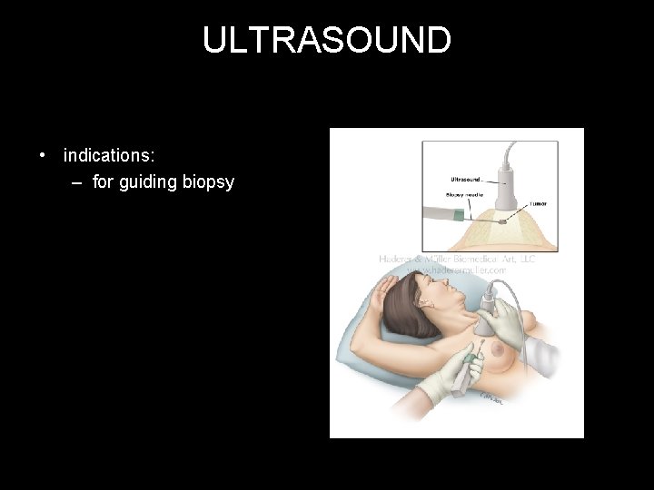 ULTRASOUND • indications: – for guiding biopsy 