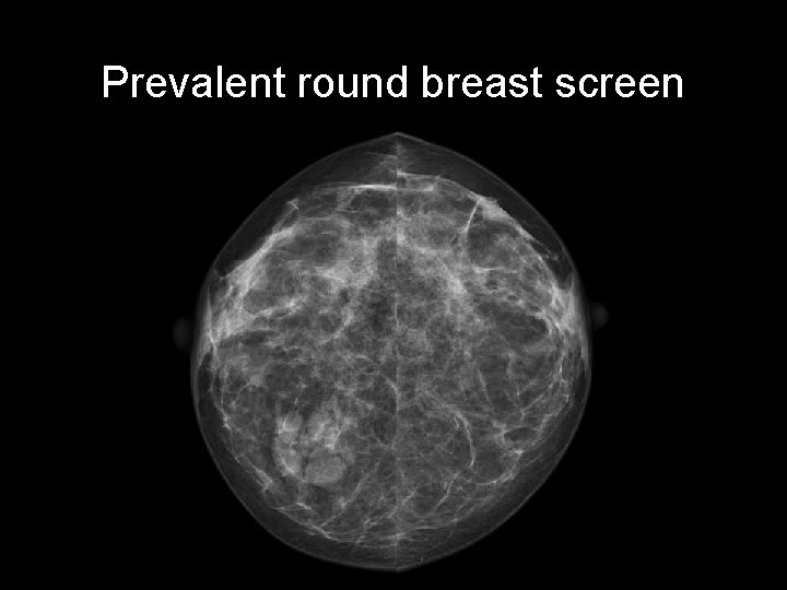 Prevalent round breast screen 