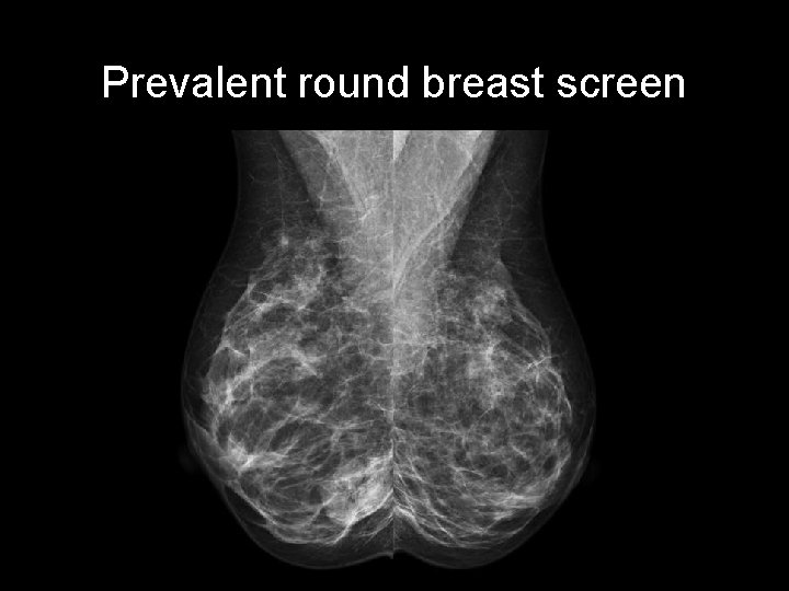 Prevalent round breast screen 