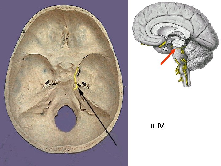 n. IV. 