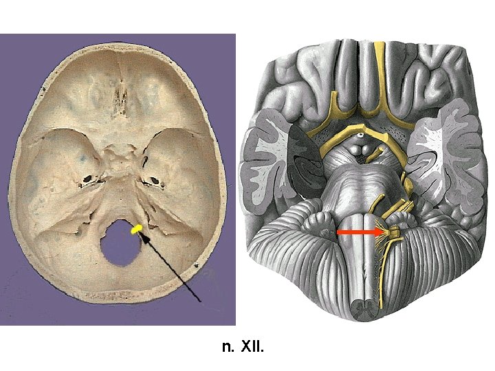 n. XII. 
